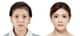Slider image (10) JK Plastic Surgery Korea Aesthetic Surgery Clinic